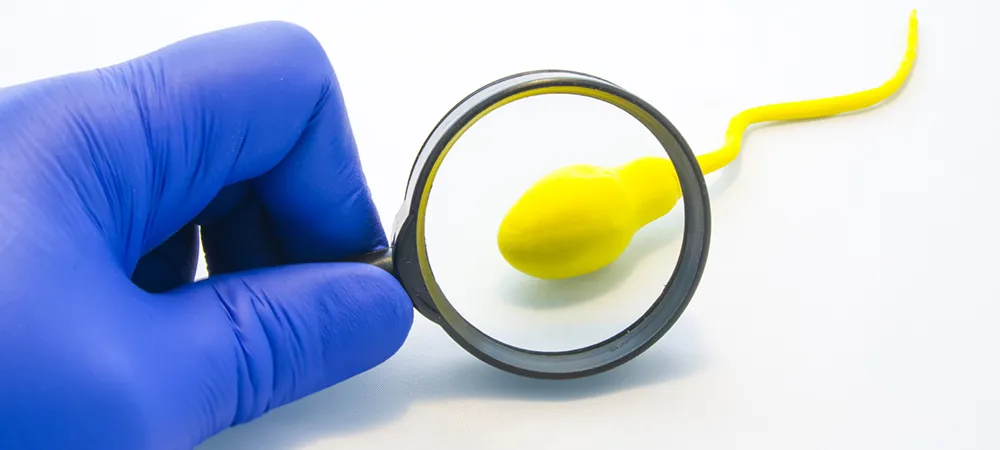 Sağlıklı Bilgiler - Sperm kalitesini arttırmanın yolları nelerdir? Sperm kalitesini neler düşürür?