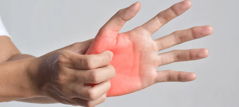 Avuç içi kaşıntısı neden olur? Avuç içi kaşıntısı neyin belirtisidir?