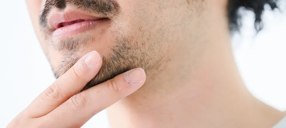 Sakal iltihabı neden olur? Sakal iltihabı nasıl geçer?