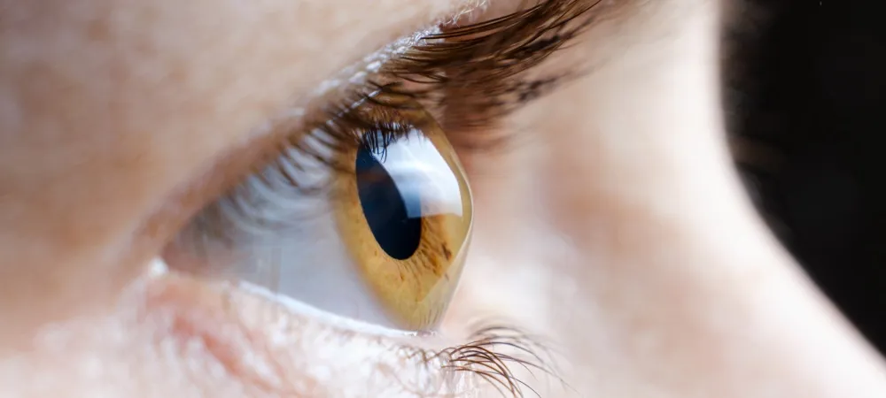 Keratokonus nedir? Keratokonus belirtileri nelerdir?