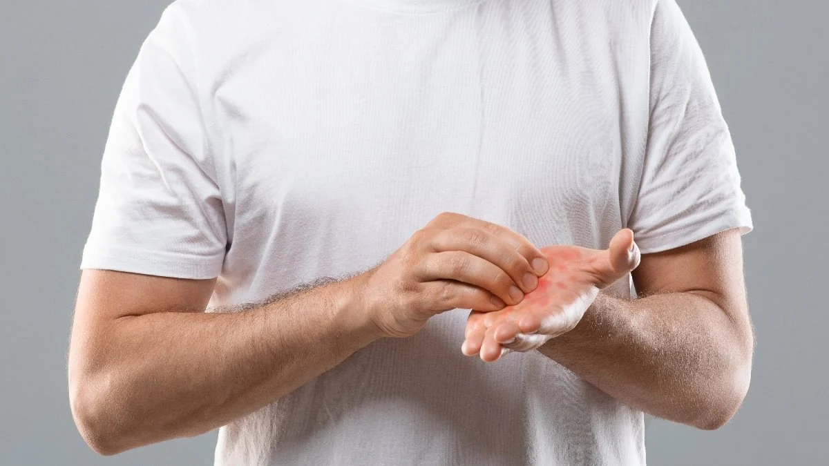 Avuç içi kaşıntısı neden olur? Avuç içi kaşıntısı neyin belirtisidir?