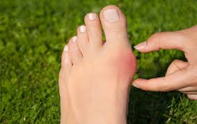 Ayak başparmak ağrısı neden olur? Ayak başparmak ağrısı nasıl geçer?